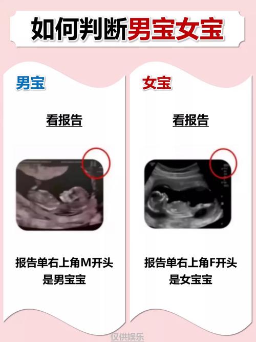 孕期如何鉴定孩子生父？-第1张图片-中州医学会