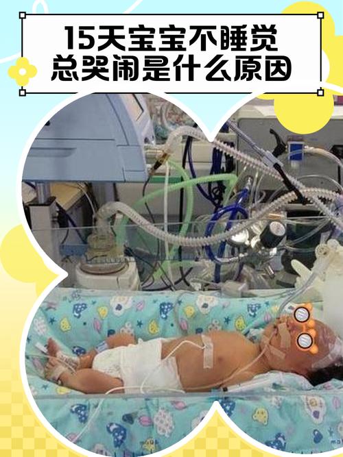 15天新生儿白天不睡怎么办？-第3张图片-中州医学会