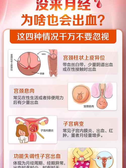 怀孕宫颈息肉出血怎么办？-第3张图片-中州医学会