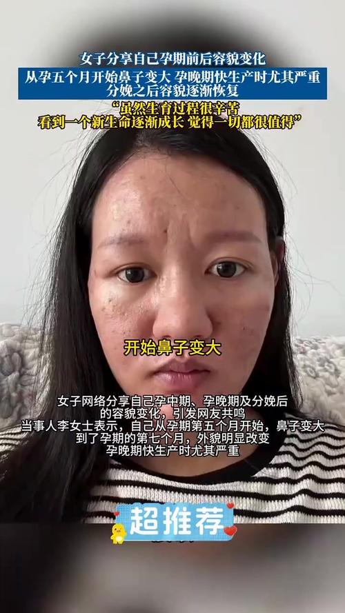 怀孕期鼻子变大是激素作怪吗?-第3张图片-中州医学会 怀孕期鼻子变大是激素作怪吗?-第3张图片-中州医学会