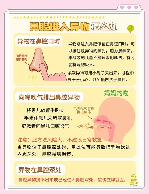 新生儿鼻屎堵塞怎么办？-第3张图片-中州医学会