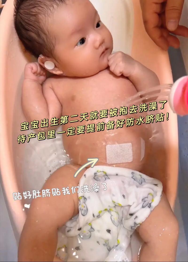 新生儿肚脐脱落后多久能洗澡？-第2张图片-中州医学会
