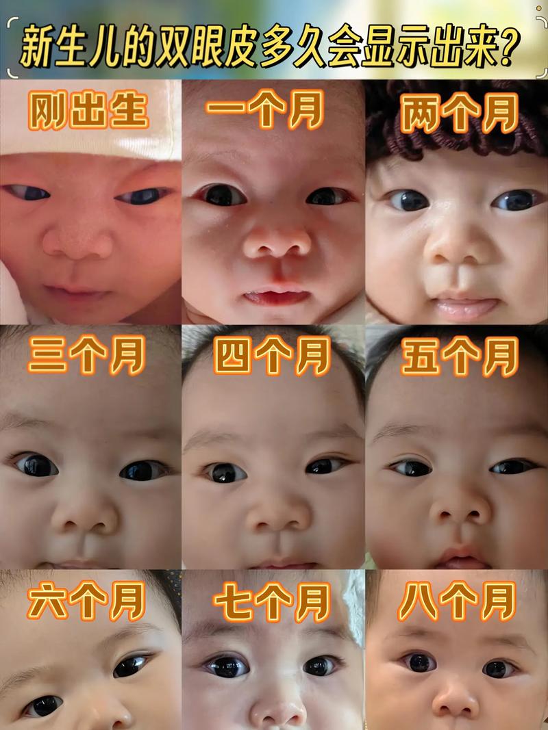 新生儿双眼大小不一，需警惕吗？-第1张图片-中州医学会