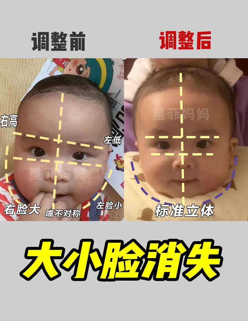 宝宝脸大小不一，会自然对称吗？-第2张图片-中州医学会