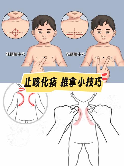 儿童止咳化痰最快最有效的方法-第1张图片-中州医学会