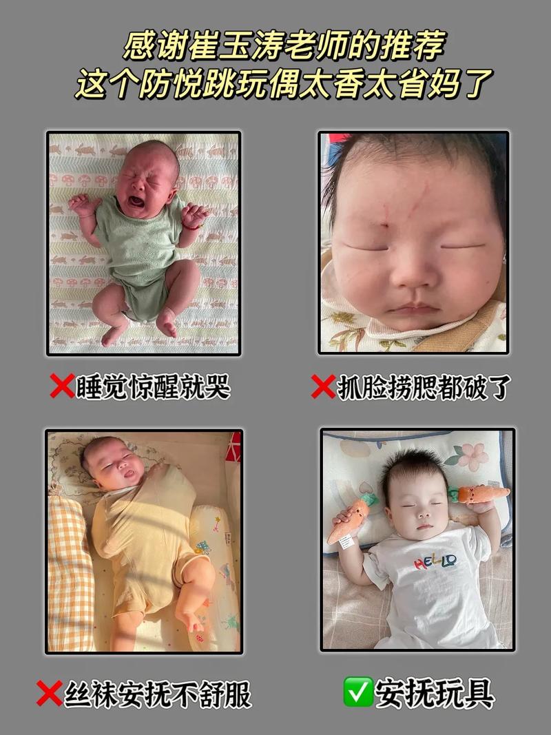 新生儿为何总是一惊一乍？-第3张图片-中州医学会