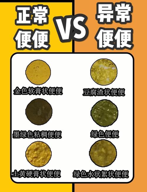 新生儿一天拉七八次大便正常吗-第1张图片-中州医学会