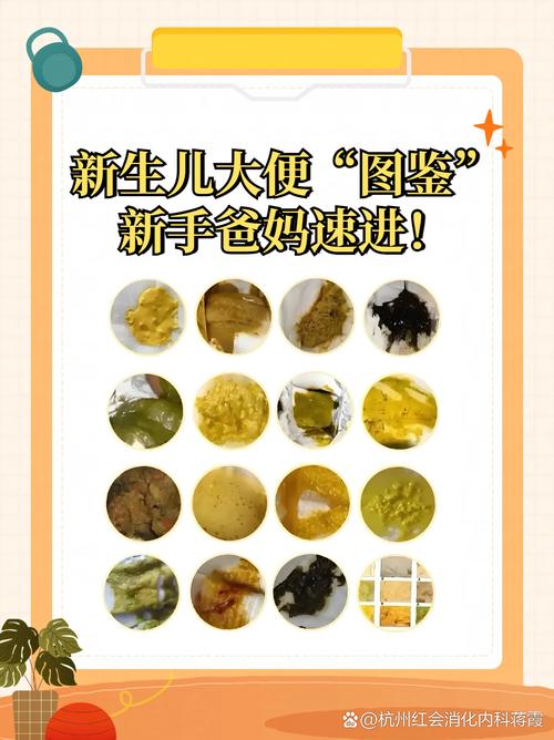 新生儿吃奶粉一天大便几次正常?-第3张图片-中州医学会 新生儿吃奶粉一天大便几次正常?-第3张图片-中州医学会