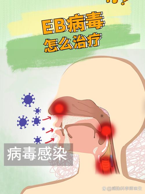 儿童感染EB病毒多久能好？-第2张图片-中州医学会