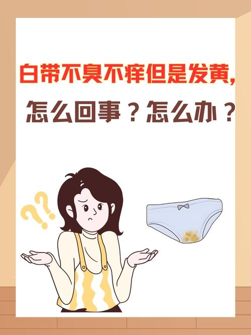 孕期白带发黄粘稠是何原因?-第3张图片-中州医学会 孕期白带发黄粘稠是何原因?-第3张图片-中州医学会