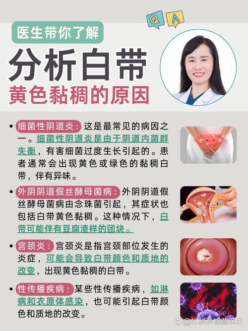 孕期白带发黄粘稠是何原因?-第2张图片-中州医学会 孕期白带发黄粘稠是何原因?-第2张图片-中州医学会