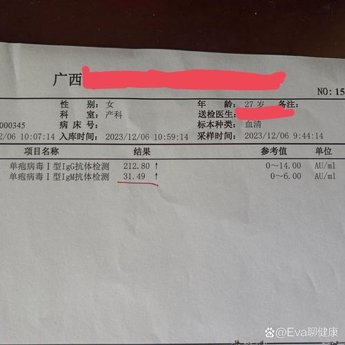 孕期单纯疱疹病毒IgM阳性怎么办？-第2张图片-中州医学会