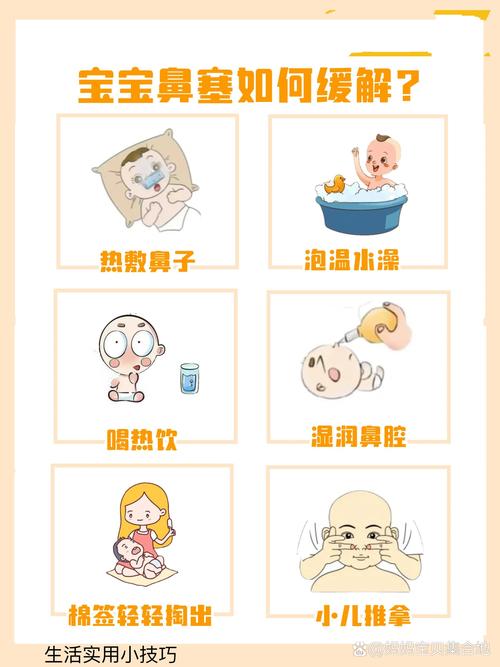 新生儿鼻子不通气，总不通气怎么办？-第2张图片-中州医学会