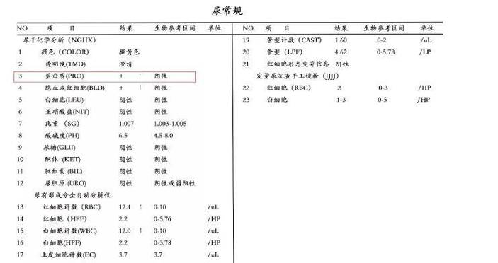儿童少尿24小时尿量少于多少算异常？-第3张图片-中州医学会