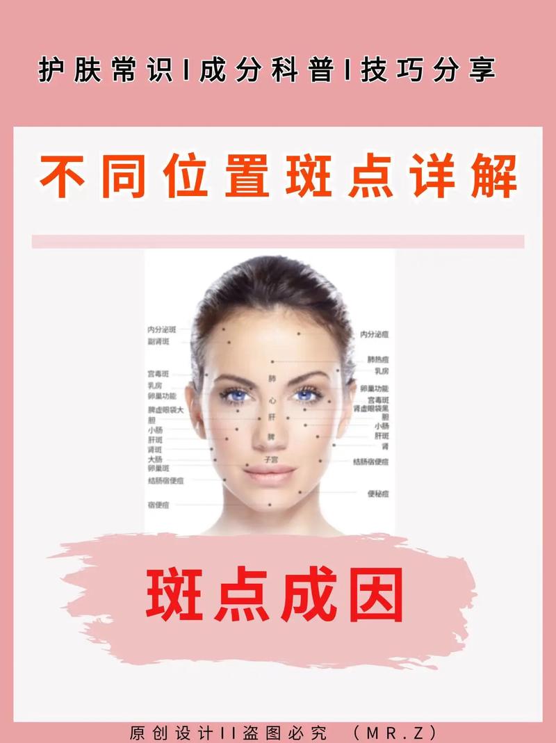 孕期面斑成因揭秘？-第3张图片-中州医学会