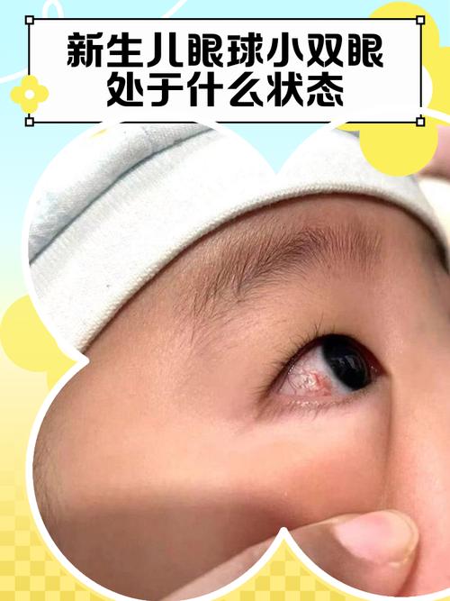新生儿出生几天眼睛能看见东西?-第1张图片-中州医学会 新生儿出生几天眼睛能看见东西?-第1张图片-中州医学会