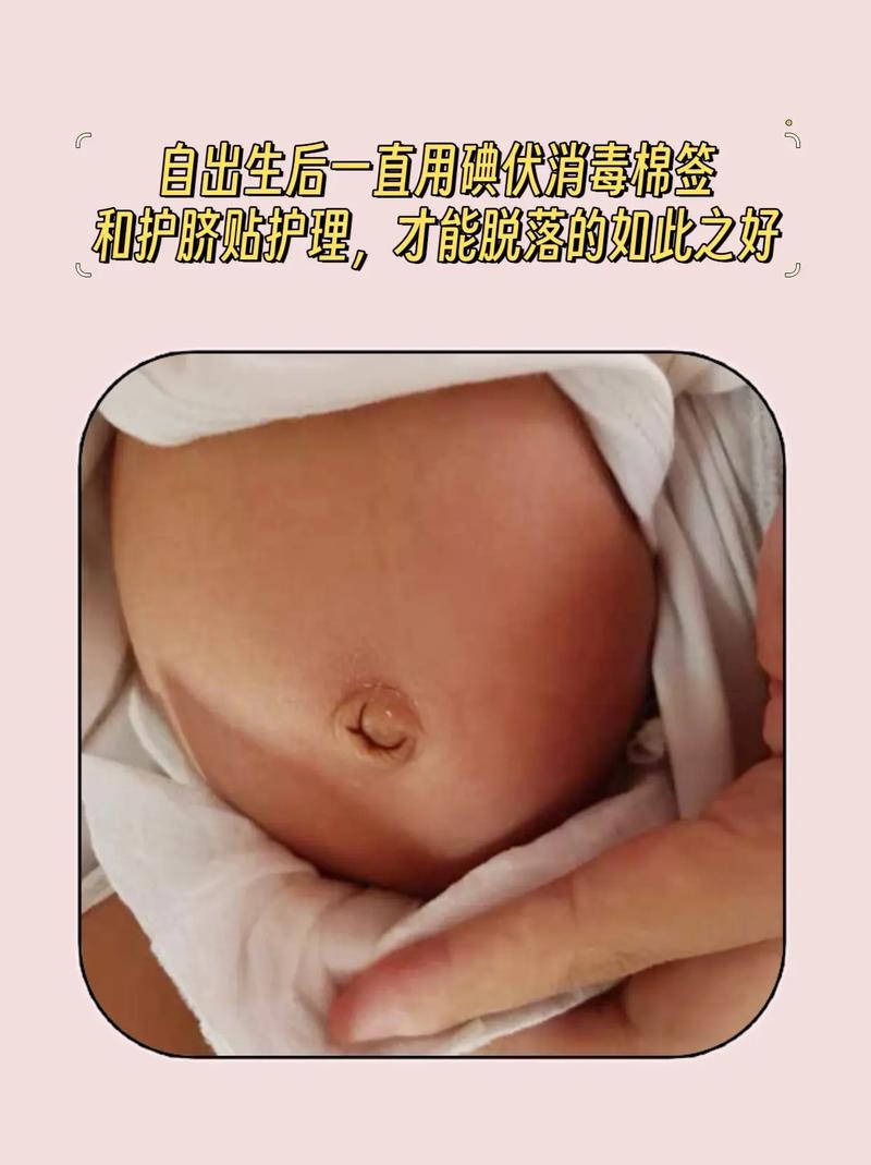 新生儿肚脐出血能洗澡吗？-第2张图片-中州医学会