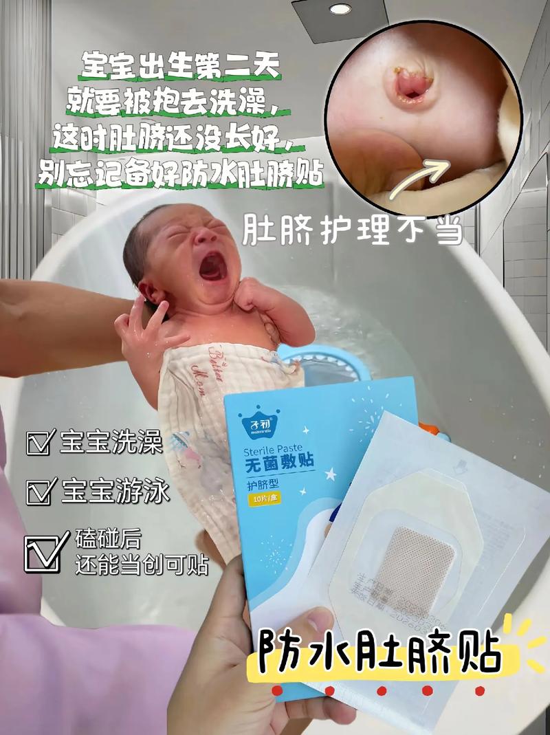 新生儿肚脐出血能洗澡吗？-第3张图片-中州医学会