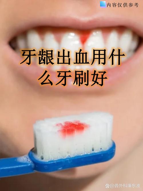 孕期刷牙总出血,是身体缺信号吗?-第3张图片-中州医学会 孕期刷牙总出血,是身体缺信号吗?-第3张图片-中州医学会