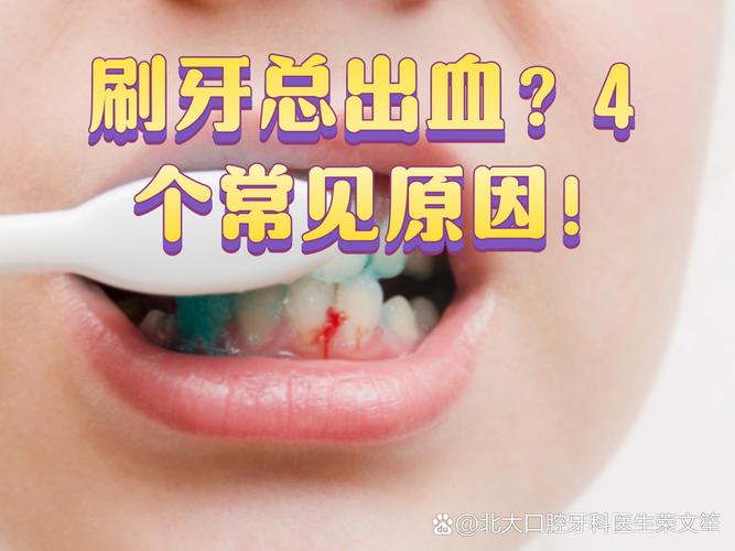 孕期刷牙总出血,是身体缺信号吗?-第1张图片-中州医学会 孕期刷牙总出血,是身体缺信号吗?-第1张图片-中州医学会