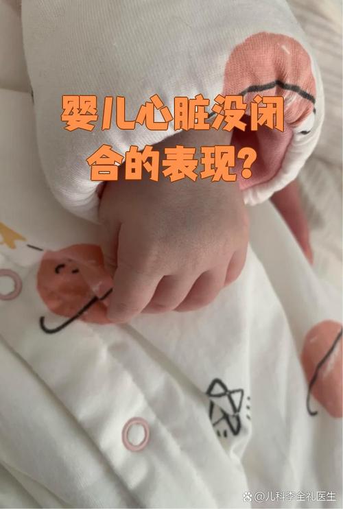 新生儿嘴周发青是缺氧还是其他问题？-第3张图片-中州医学会