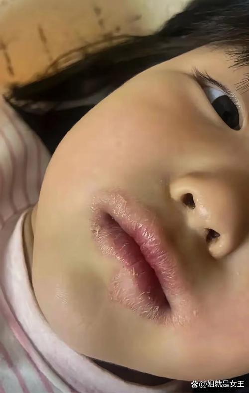 新生儿嘴周发青是缺氧还是其他问题？-第2张图片-中州医学会