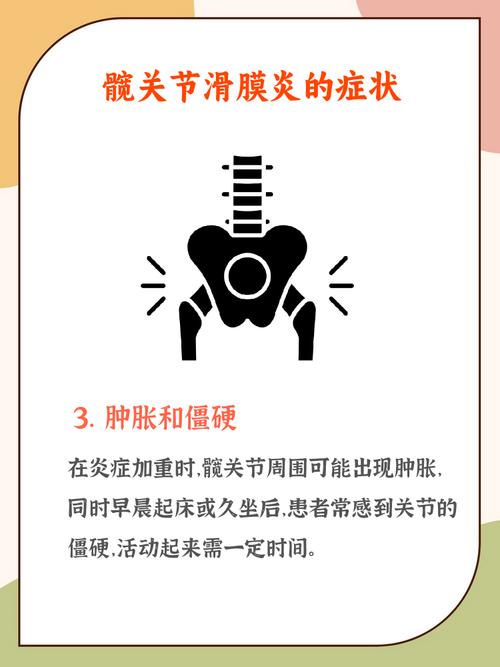 儿童髋关节滑膜炎最佳治疗方法是什么？-第3张图片-中州医学会