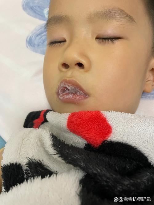 新生儿吐泡泡是正常现象吗？需警惕哪些问题？-第1张图片-中州医学会