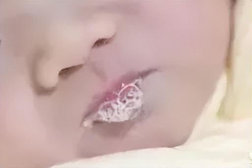 新生儿吐泡泡是正常现象吗？需警惕哪些问题？-第2张图片-中州医学会