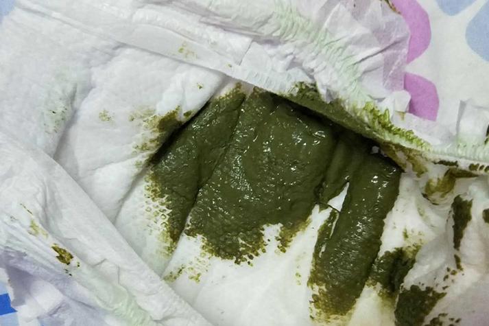 新生儿绿色大便何因？-第2张图片-中州医学会