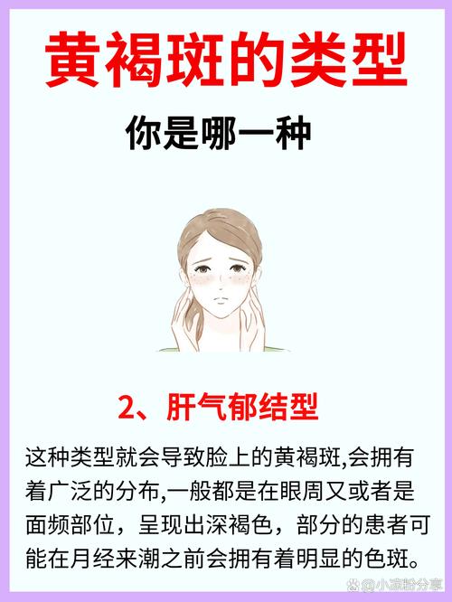 孕期脸色发黄是何原因？-第2张图片-中州医学会