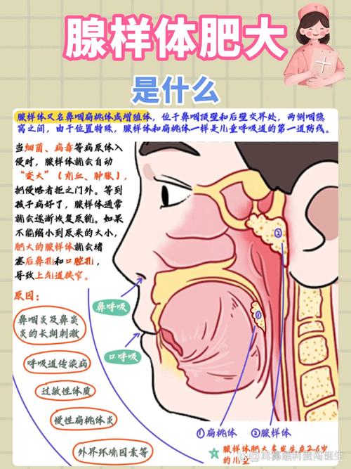 儿童腺样体肥大，哪种治疗方式更优？-第3张图片-中州医学会