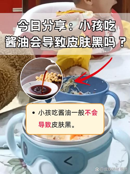 孕期吃酱油会让宝宝皮肤变黑吗？-第1张图片-中州医学会