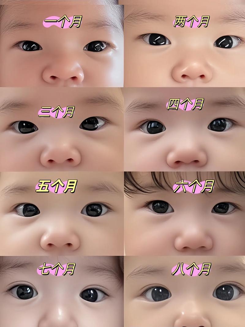 新生儿眼睛一大一小咋办？-第3张图片-中州医学会