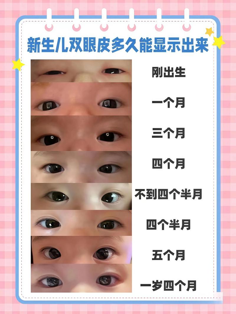 新生儿眼睛一大一小咋办？-第1张图片-中州医学会