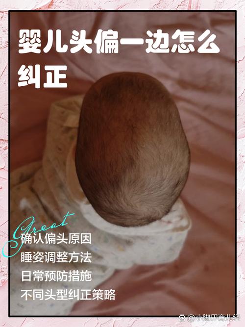 宝宝脸一大一小，是歪了吗？-第3张图片-中州医学会