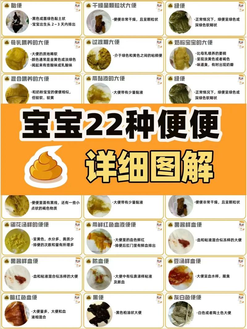 新生儿一天未排便正常吗?-第3张图片-中州医学会 新生儿一天未排便正常吗?-第3张图片-中州医学会