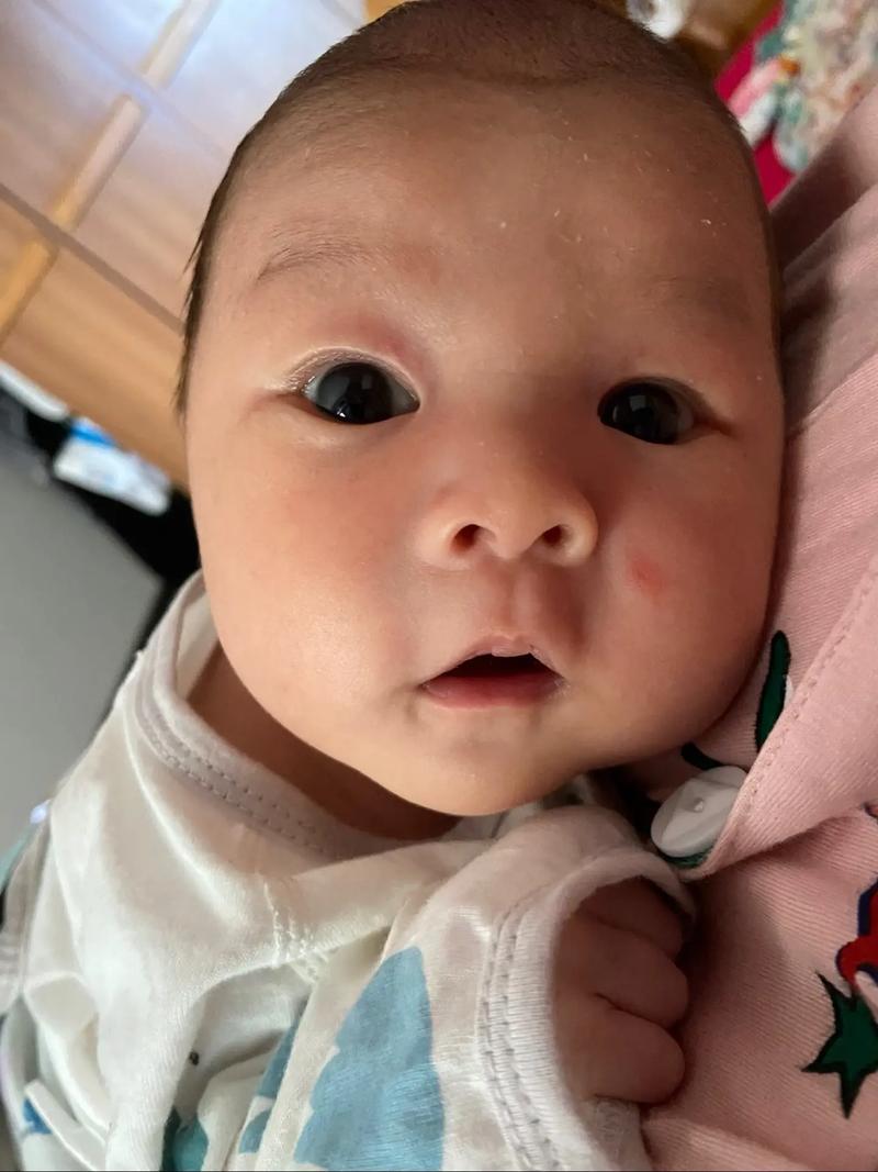 新生儿眼睛一大一小是何原因？-第1张图片-中州医学会