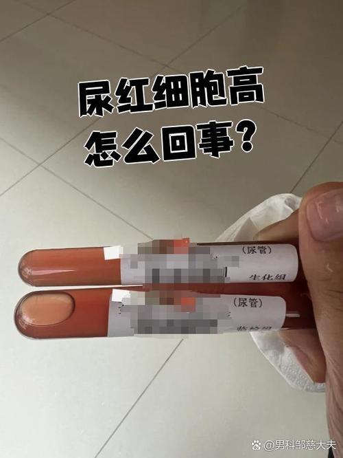 孕期尿检红细胞高，是哪些原因导致的？-第2张图片-中州医学会