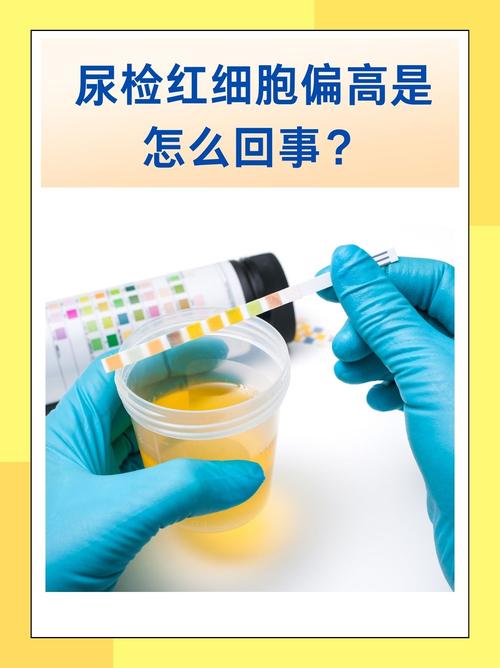 孕期尿检红细胞高，是哪些原因导致的？-第3张图片-中州医学会