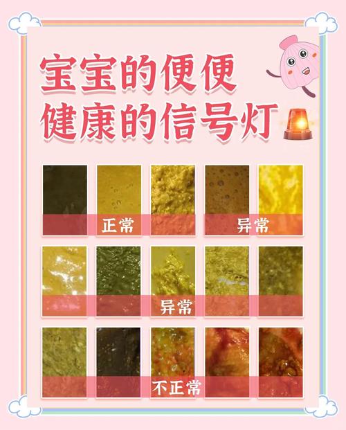 新生儿一天拉几次大便算正常？-第1张图片-中州医学会