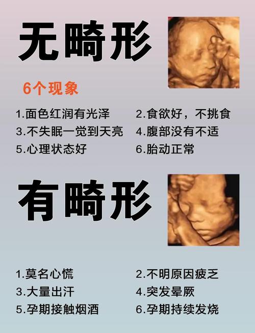 孕期玩手机会导致胎儿畸形吗？-第2张图片-中州医学会