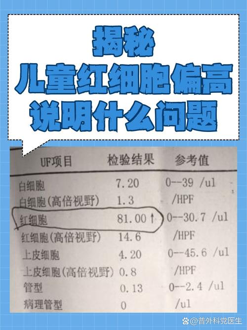 新生儿血项高是什么原因引起的-第2张图片-中州医学会 新生儿血项高是什么原因引起的-第2张图片-中州医学会