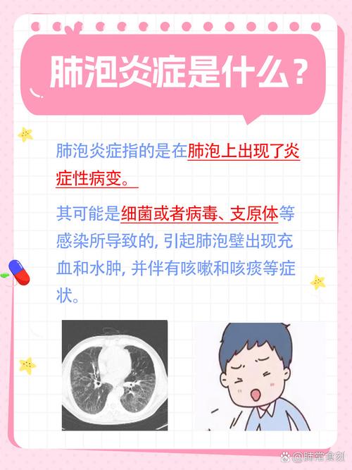 新生儿肺透明膜病主因是啥?-第2张图片-中州医学会 新生儿肺透明膜病主因是啥?-第2张图片-中州医学会