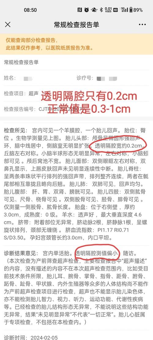 新生儿肺透明膜病主因是啥?-第3张图片-中州医学会 新生儿肺透明膜病主因是啥?-第3张图片-中州医学会