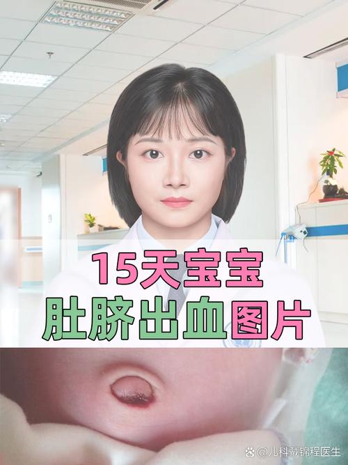 新生儿8天肚脐出血怎么办？-第1张图片-中州医学会