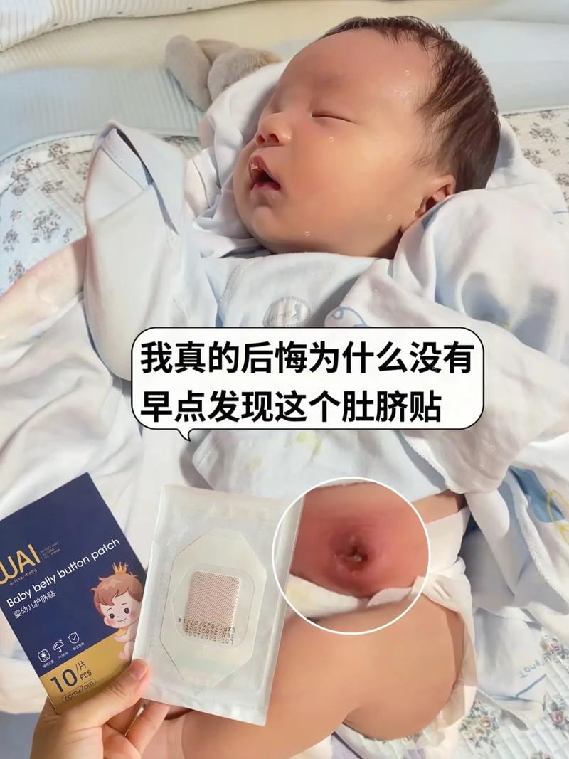 新生儿8天肚脐出血怎么办？-第2张图片-中州医学会