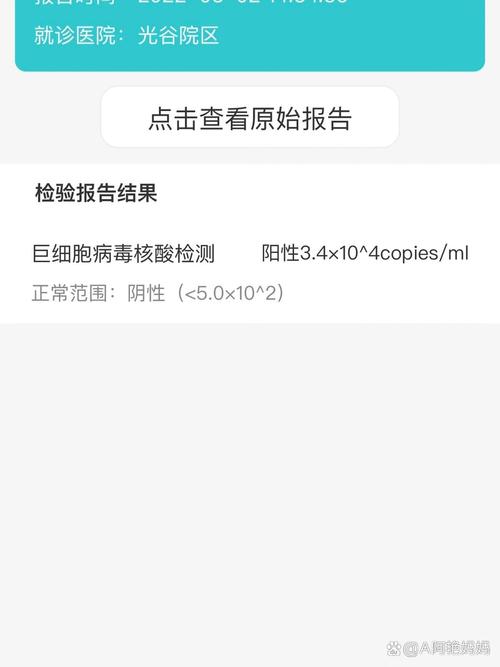 新生儿巨细胞病毒感染能治好吗？-第2张图片-中州医学会
