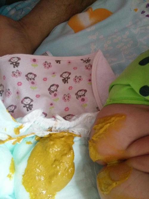 新生儿使劲就排便，正常吗？-第1张图片-中州医学会