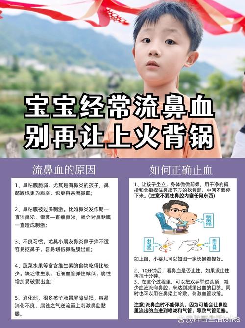 儿童流鼻血最简单处理方法是什么?-第3张图片-中州医学会 儿童流鼻血最简单处理方法是什么?-第3张图片-中州医学会